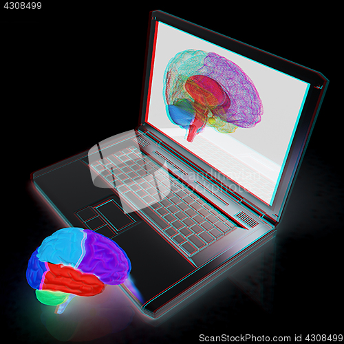 Image of creative three-dimensional model of real human brain and scan on