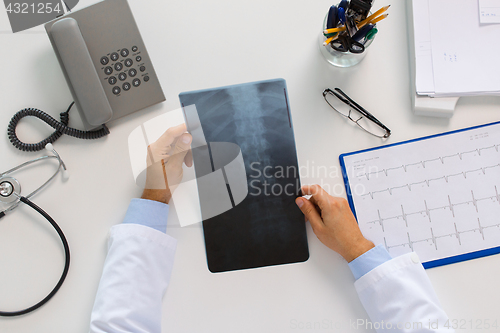 Image of doctor hands with spine x-ray sitting at table