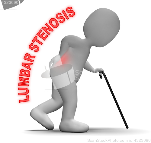 Image of Lumbar Stenosis Indicates Vertebral Column And Backbone 3d Rende