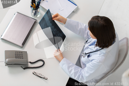 Image of doctor with spine x-ray sitting at table
