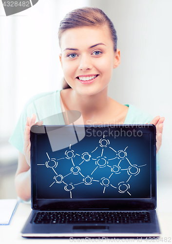 Image of girl holding laptop with network contacts