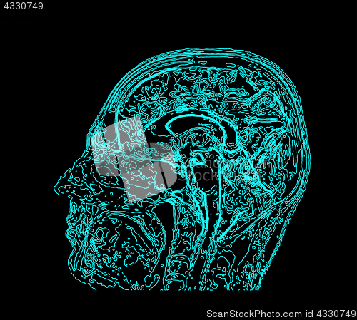 Image of Topographic map MRI of the human brain.