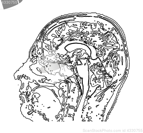 Image of Topographic map MRI of the human brain.