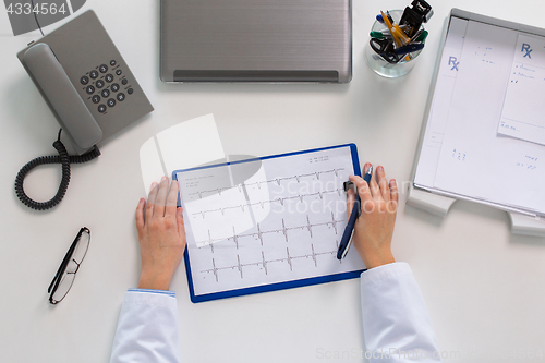 Image of doctor hands with cardiogram at table