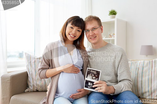 Image of happy couple with ultrasound images at home