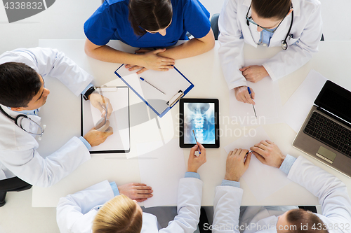 Image of doctors with spine x-ray on tablet pc computer