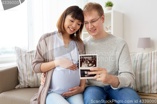 Image of happy couple with ultrasound images at home