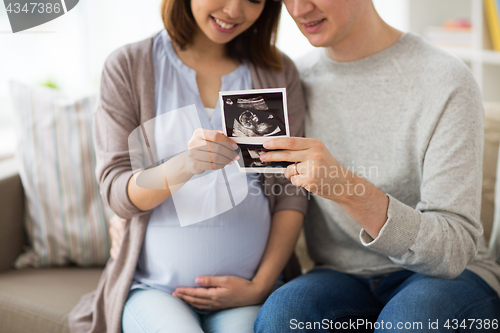 Image of couple with baby ultrasound images at home