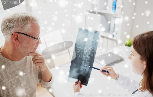 Image of doctor with spine x-ray and senior man at hospital