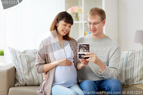 Image of happy couple with ultrasound images at home