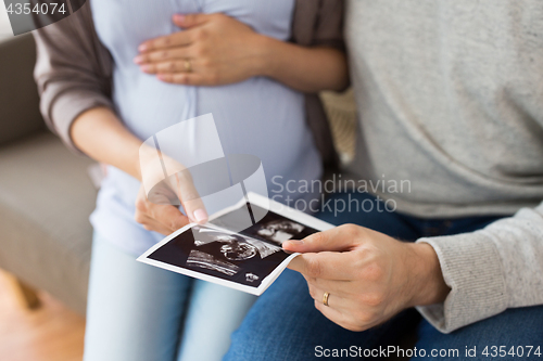 Image of close up of couple with baby ultrasound images