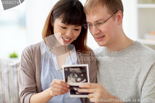 Image of close up of happy couple with baby ultrasound