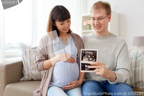 Image of happy couple with ultrasound images at home