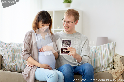 Image of happy couple with ultrasound images at home