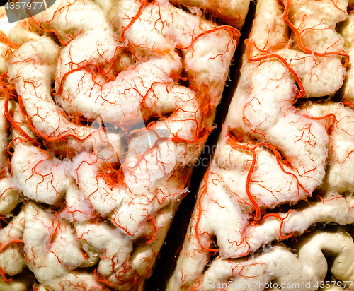 Image of Human brain closeup