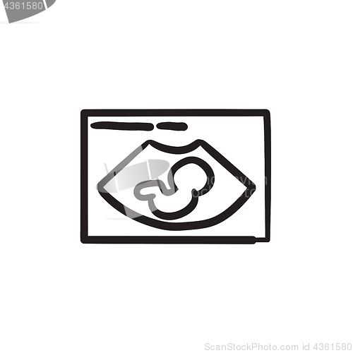 Image of Fetal ultrasound sketch icon.