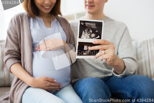 Image of close up of couple with baby ultrasound images