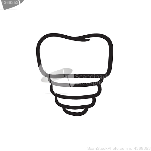 Image of Tooth implant sketch icon.