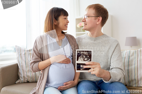 Image of happy couple with ultrasound images at home