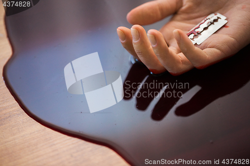 Image of dead woman hand in blood on floor at crime scene