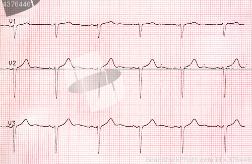 Image of Electrocardiogram graph on paper