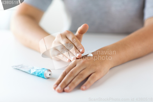 Image of close up of hands with cream or therapeutic salve