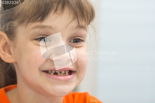 Image of Seven-year-old girl with a smile looks at her curves baby teeth