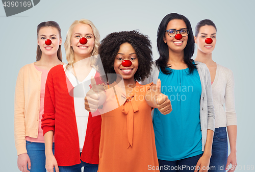 Image of group of women showing thumbs up at red nose day