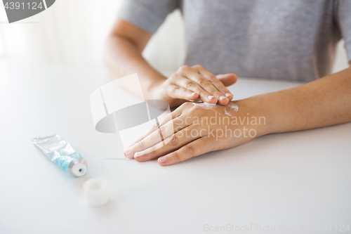 Image of close up of hands with cream or therapeutic salve