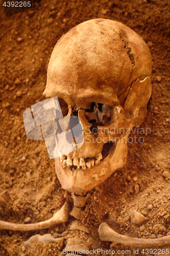 Image of old human skull