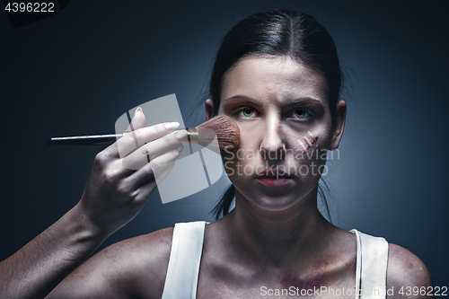 Image of Close up portrait of a crying woman with bruised skin and black eyes