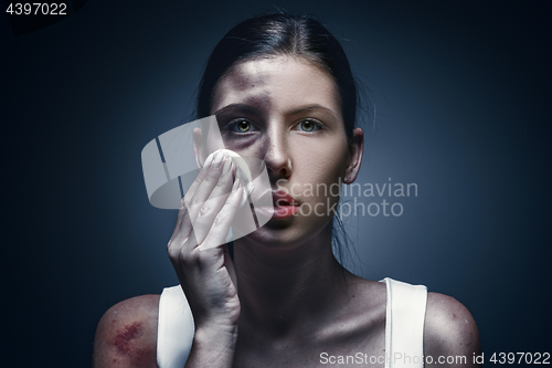 Image of Close up portrait of a crying woman with bruised skin and black eyes