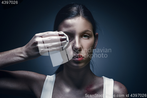 Image of Close up portrait of a crying woman with bruised skin and black eyes