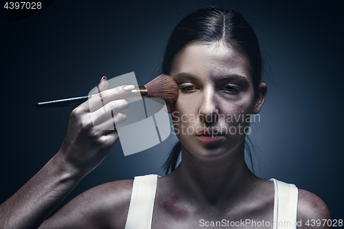 Image of Close up portrait of a crying woman with bruised skin and black eyes