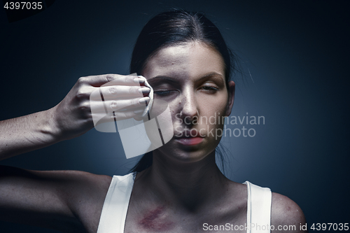 Image of Close up portrait of a crying woman with bruised skin and black eyes