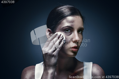 Image of Close up portrait of a crying woman with bruised skin and black eyes