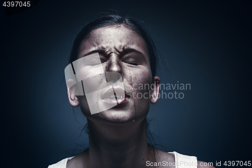 Image of Close up portrait of a crying woman with bruised skin and black eyes