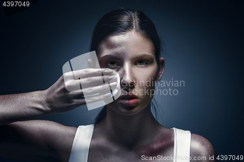 Image of Close up portrait of a crying woman with bruised skin and black eyes