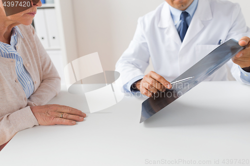 Image of senior woman and doctor with x-ray at hospital