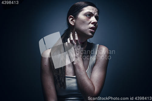 Image of Close up portrait of a crying woman with bruised skin and black eyes