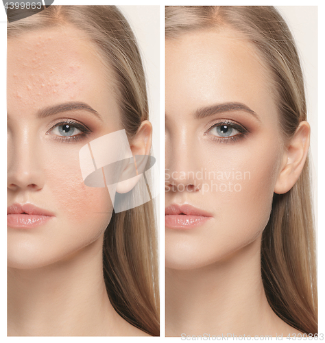 Image of Woman before and after treatment