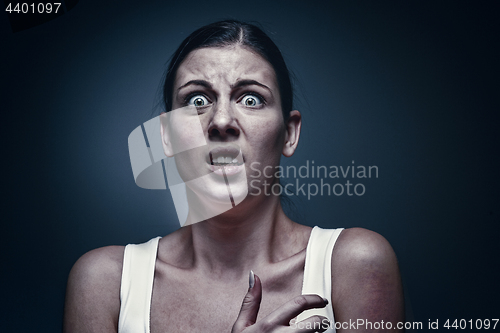 Image of Close up portrait of a crying woman with bruised skin and black eyes