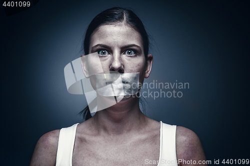 Image of a young girl with a patch on her mouth