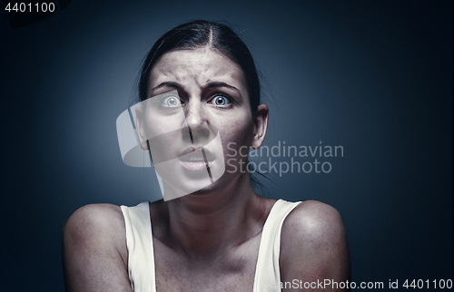 Image of Close up portrait of a crying woman with bruised skin and black eyes