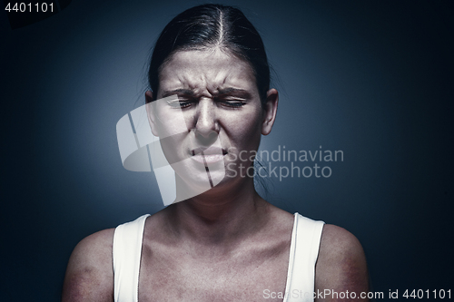 Image of Close up portrait of a crying woman with bruised skin and black eyes