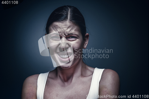 Image of Close up portrait of a crying woman with bruised skin and black eyes