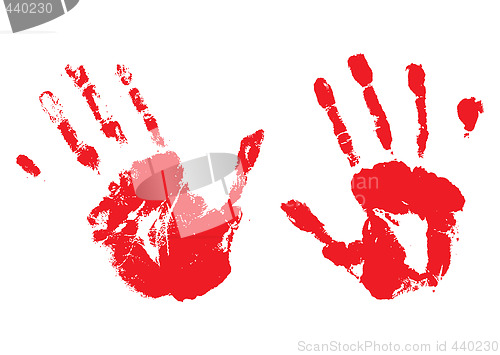 Image of bloody hands