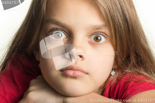 Image of Close-up portrait of a teenage girl with bulging eyes