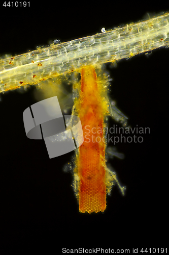 Image of Microscopic view of unspecified eggs in tube shaped packet on Co