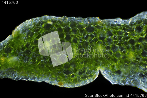 Image of Microscopic view of a Showy stonecrop (Hylotelephium spectabile)